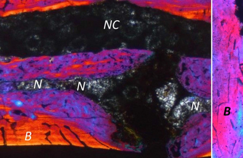 Палеонтологи обнаружили у вымерших рептилий межпозвоночные диски