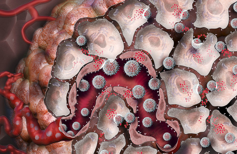 Наночастицы против рака: прорыв в онкологии