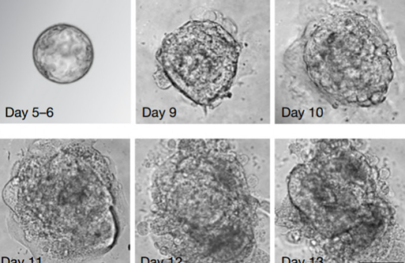 Как эмбрион человека прожил в пробирке 13 дней