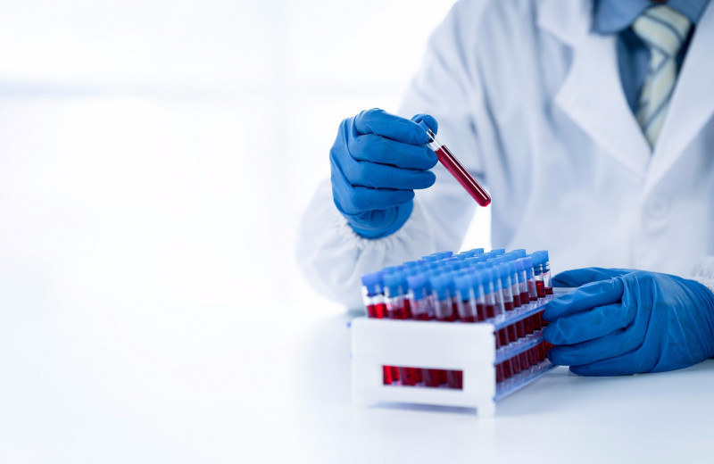 Генетическое тестирование: зачем оно нужно и почему мы (не) решаемся его сделать?