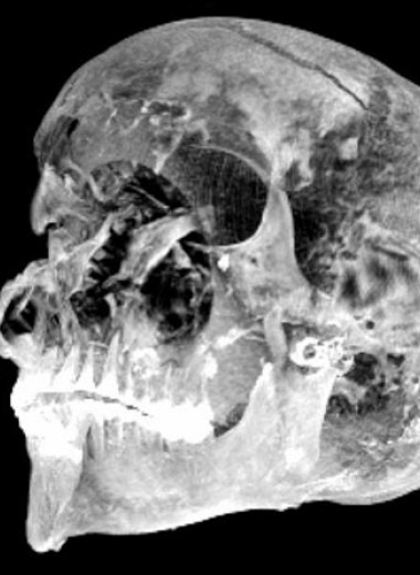 Компьютерная томография подтвердила драматическую гибель египетского царя