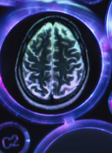 Найдено лекарство от болезни Альцгеймера?