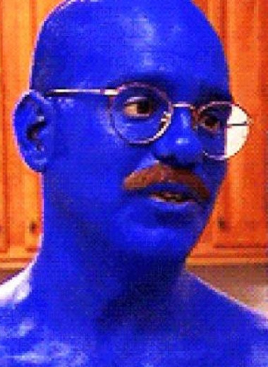 ПТСР и патологии сна повысили риск развития острого коронарного синдрома