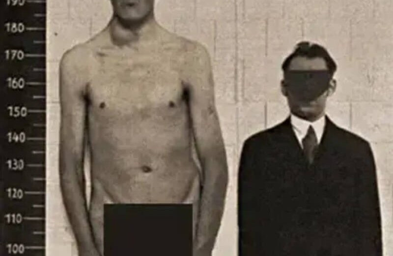 Он вырос от карлика до гиганта! Загадочная история Адама Райнера