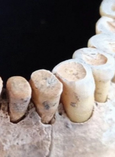 На юге Италии нашли похороненного ничком мужчину эпохи неолита
