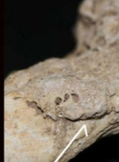 Инфекционный артрит вызвал хромоту у древнего китайца