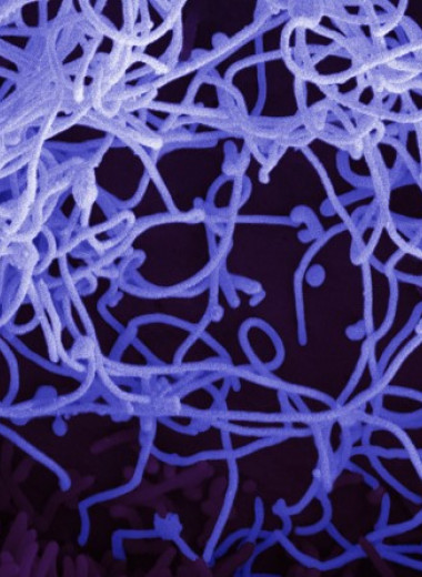 В организме больных Эболой нашли вирус пятилетней давности