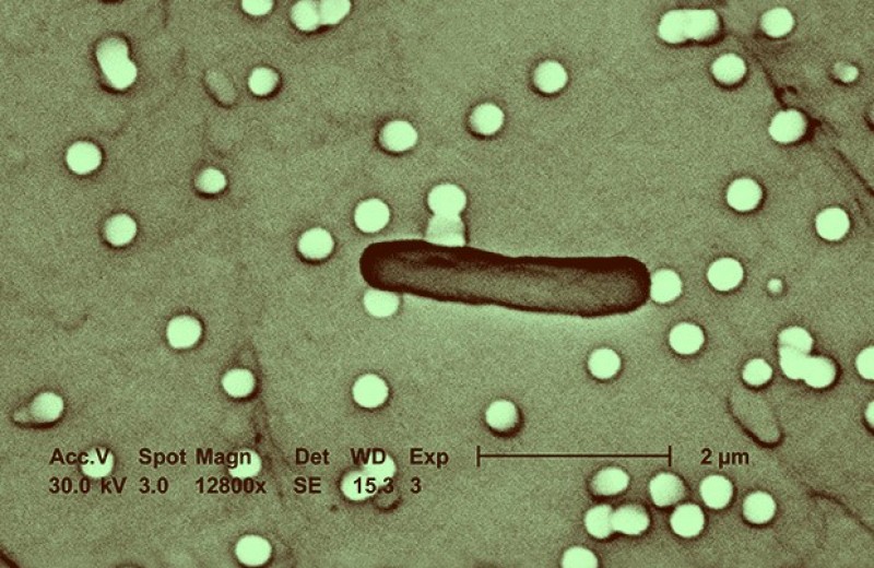 Пересадка бактерий