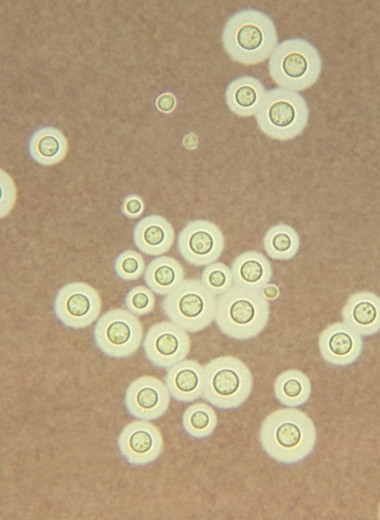 Грибок Cryptococcus neoformans 