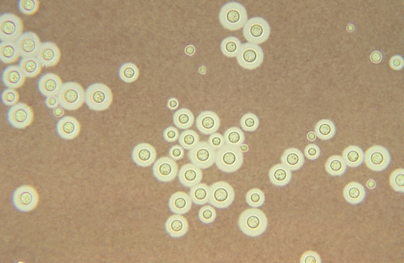Грибок Cryptococcus neoformans 