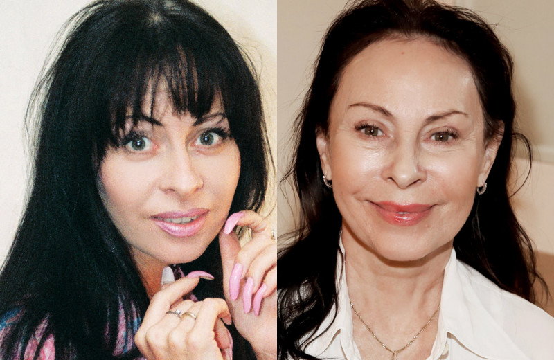 Изуродовали себя!: отечественные звезды - жертвы неудачной пластики