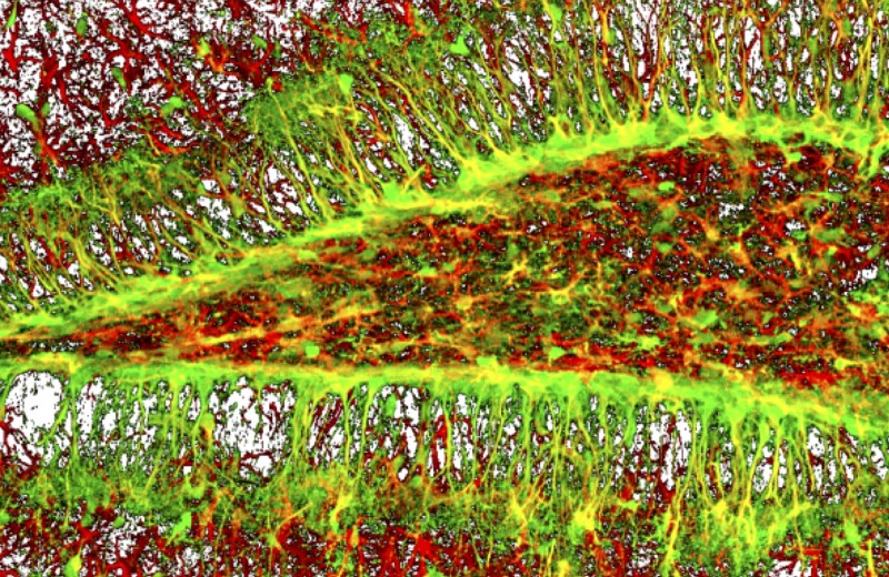 Стволовые клетки мозга обновляются ограниченно: новое открытие