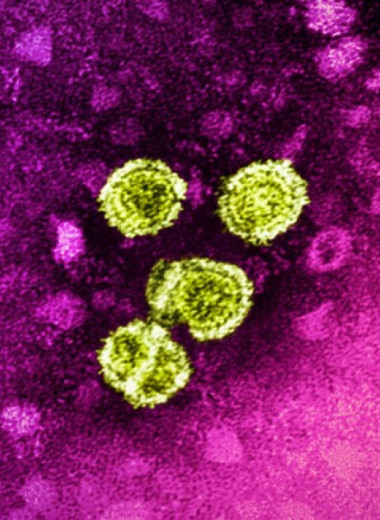ВОЗ сообщила о 3500 смертях от вирусных гепатитов в мире ежедневно
