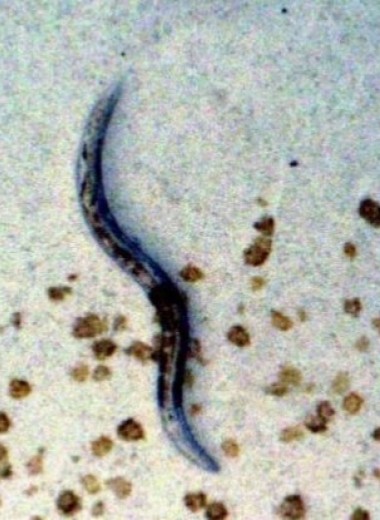 Генетики продлили жизнь червей на 500%: эликсир долголетия