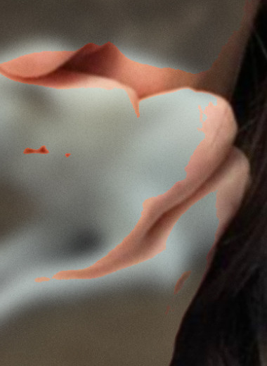 Собачий укус привел к гемолитико-уремическому синдрому у норвежки