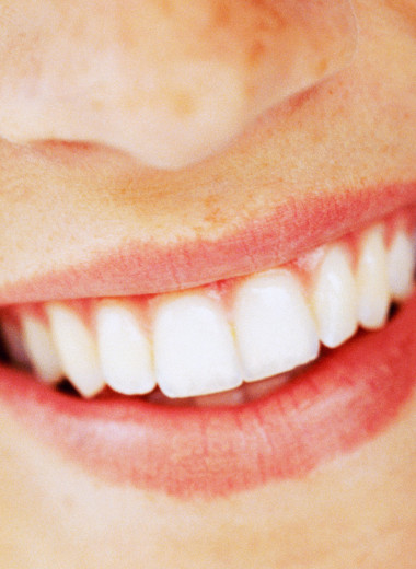 Что такое бруксизм: как скрежетание зубами портит наше здоровье