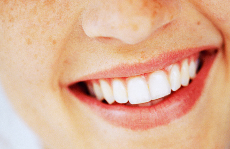 Что такое бруксизм: как скрежетание зубами портит наше здоровье