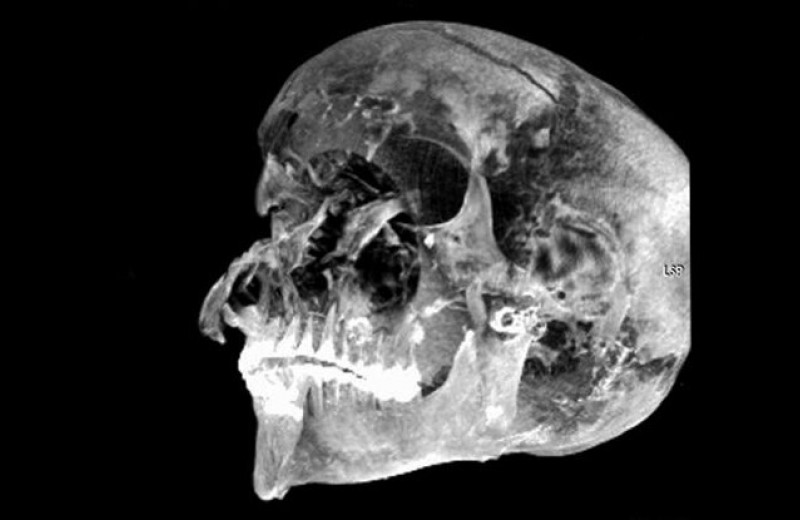 Томография древней мумии выявила страшные подробности насильственной смерти