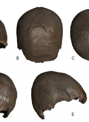 В Китае нашли один из древнейших искусственно деформированных черепов