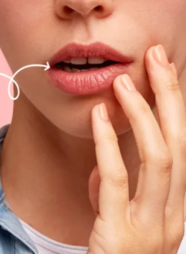 Болевые точки: почему появляются язвы во рту и как их лечить