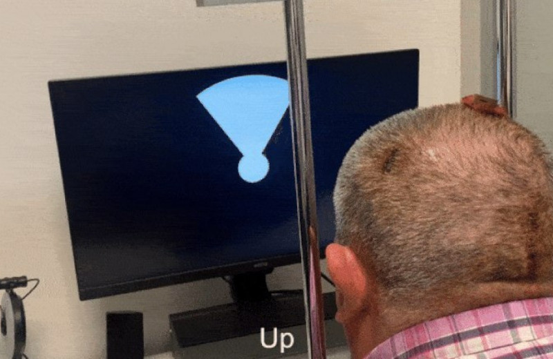 Микростимуляция зрительной коры вернула зрение пожилому испанцу