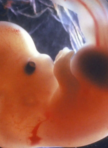 Мозг знает, как устроен мир, еще до рождения человека