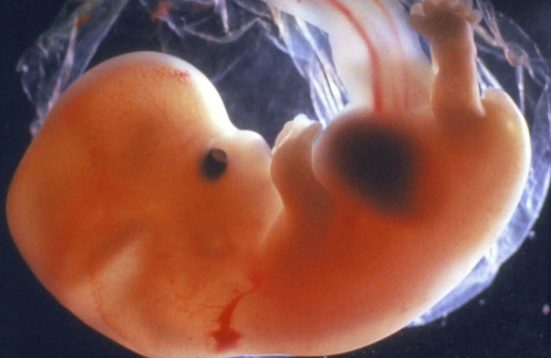 Мозг знает, как устроен мир, еще до рождения человека