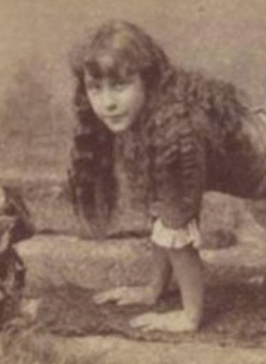 «Девочка-верблюд»: подлинная история Эллы Харпер