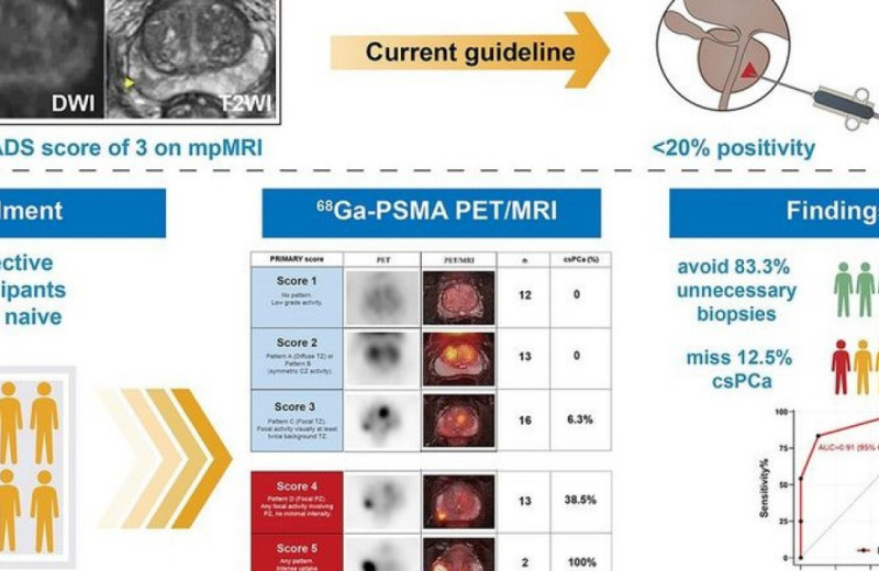 ПЭТ/МРТ помогла избежать ненужных биопсий при диагностике рака простаты