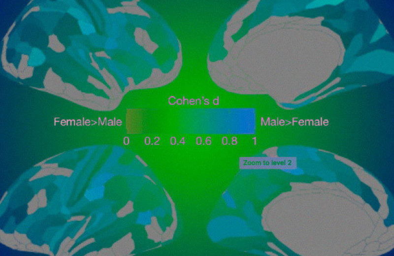 Дисбаланс активности мозга при аутизме связали с половыми различиями