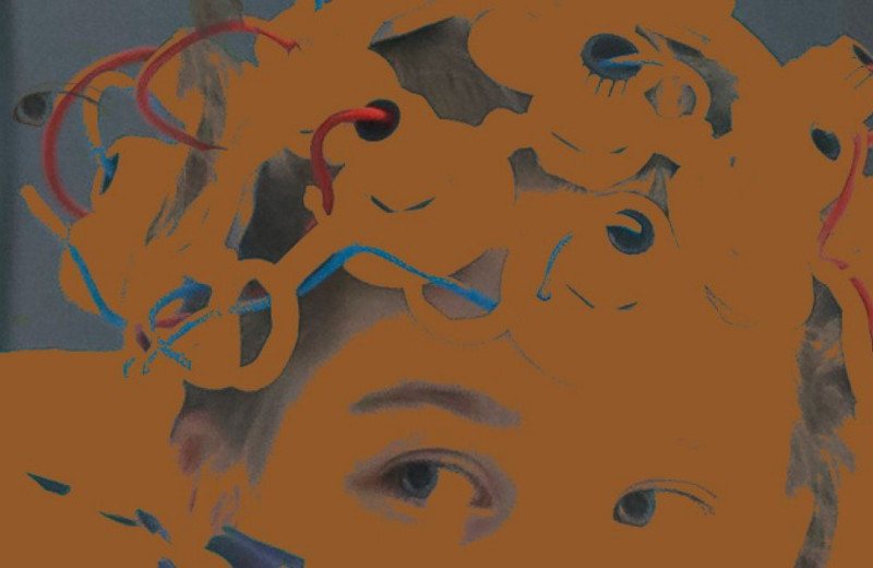 ЭЭГ-мониторинг предотвратил развитие послеоперационного психоза у детей