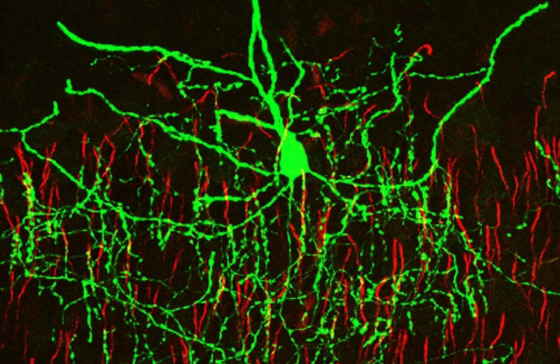 Мозг обрабатывает необычные ситуации с помощью специальных нейронов