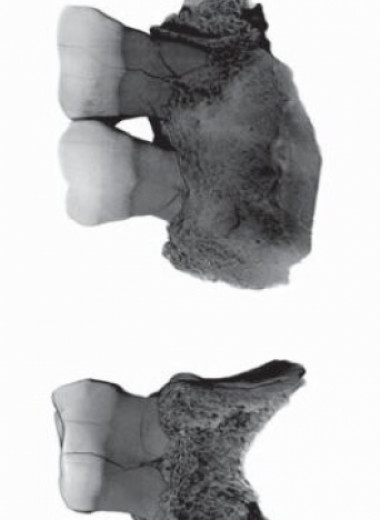 Палеоантропологи диагностировали у алтайского неандертальца верхнечелюстной синусит