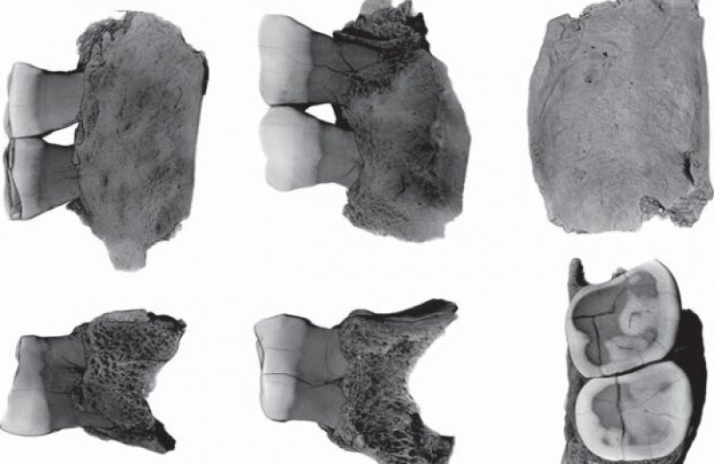 Палеоантропологи диагностировали у алтайского неандертальца верхнечелюстной синусит
