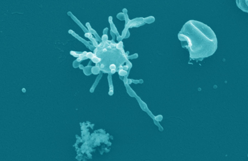 Как возникли сложные клетки, из которых состоят животные и растения