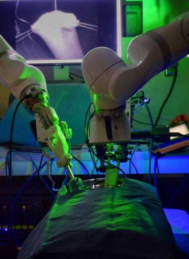 Робот-хирург впервые провел сложную операцию без вмешательства человека: инженерное чудо