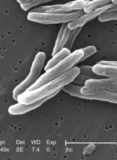Малые дозы антибиотиков превратили возбудителя туберкулеза в суперпатоген. Хотя его ДНК не изменилось