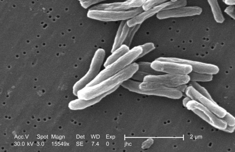 Малые дозы антибиотиков превратили возбудителя туберкулеза в суперпатоген. Хотя его ДНК не изменилось
