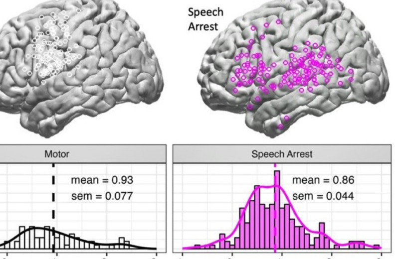 Стимуляция вентральных областей соматосенсорной коры привела к отсроченной остановке речи