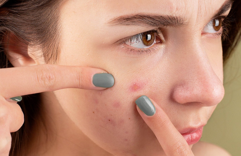 5 заболеваний, о которых может сигнализировать наша кожа