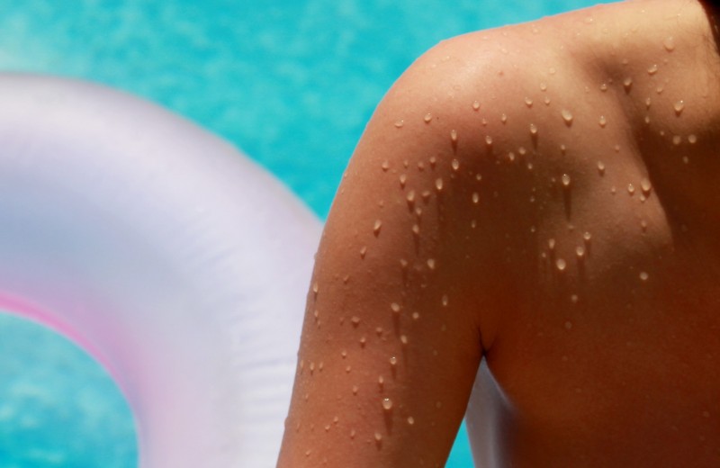 Аллергия на солнце: как защитить кожу и что делать, если она пострадала