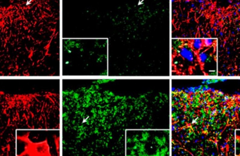 Урсоловая кислота восстановила миелиновые оболочки нейронов у мышей со склерозом