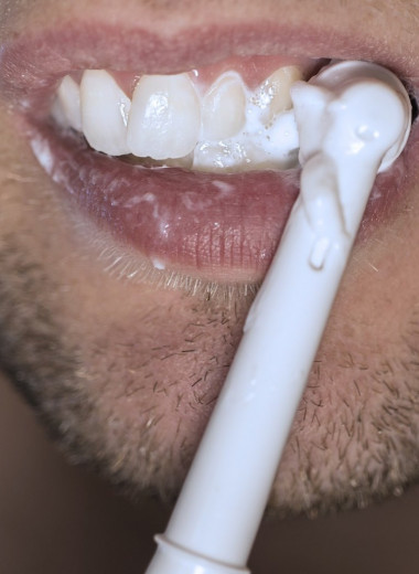 Почему желтеют наши зубы: все не так очевидно