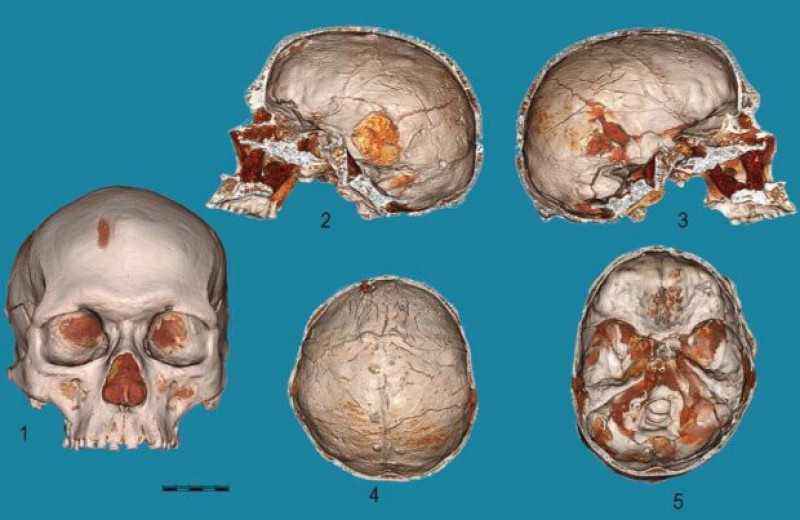 У сунгирца оказались хорошо развиты затылочные доли головного мозга