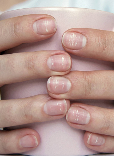 6 причин, по которым на ногтях появляются белые пятна: что делать в каждом случае