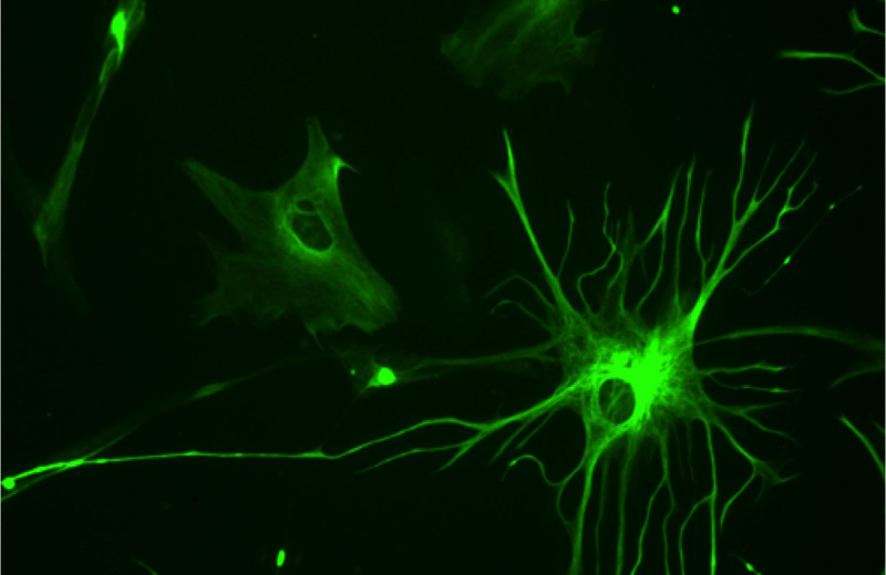 Астроциты уличили в поедании синапсов взрослых мышей
