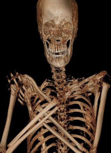 Польские археологи обнаружили первую египетскую мумию беременной женщины