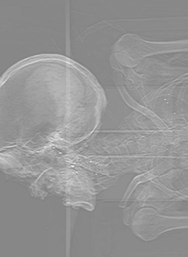 В кишечнике средневековой мумии из Китая обнаружили ртутьсодержащий раствор