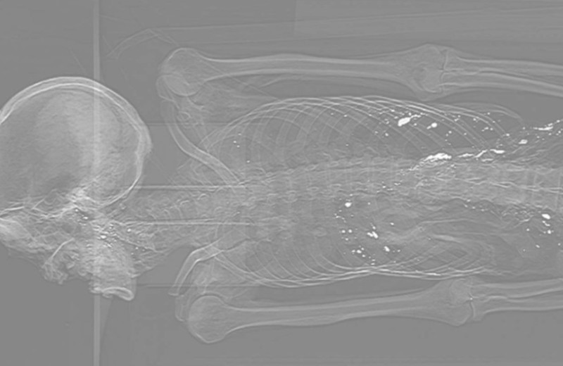 В кишечнике средневековой мумии из Китая обнаружили ртутьсодержащий раствор