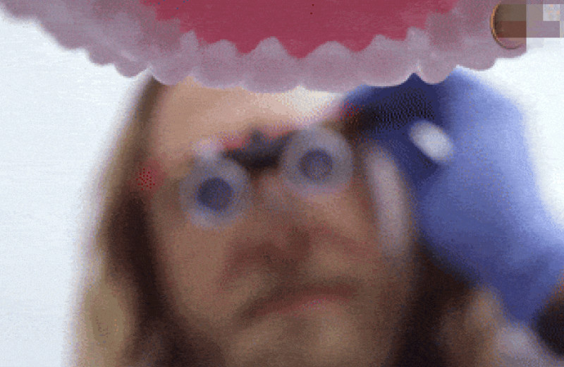 Множественный кариес в детстве повысил риск болезней сердца во взрослом возрасте